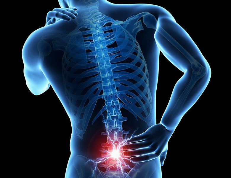back-pain